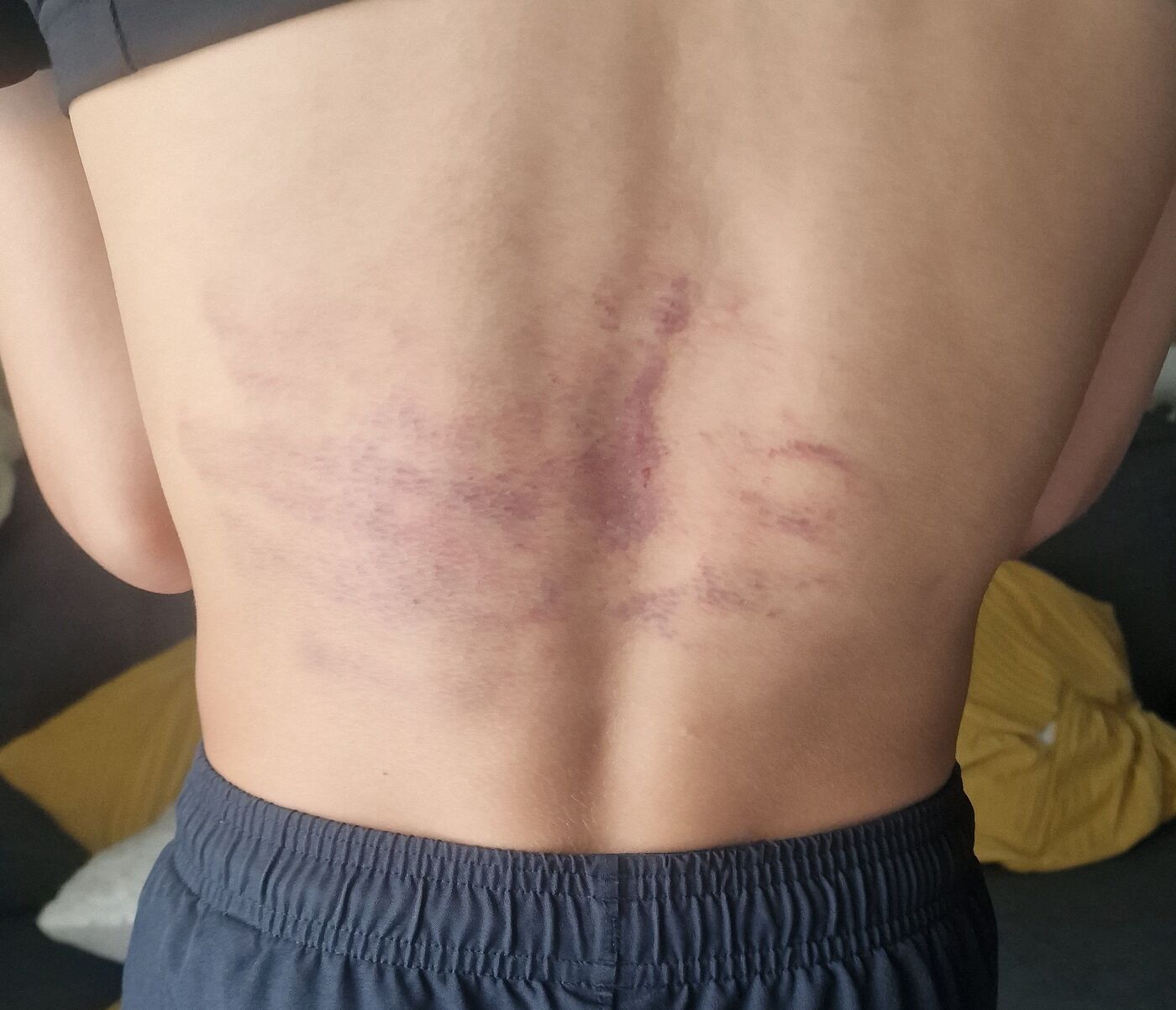 Quatre animateurs ont fait subir des violences à des adolescents du club de Clichy lors d'un séjour sportif en Espagne, notamment à l'aide de câbles de téléphone utilisés comme un fouet. DR